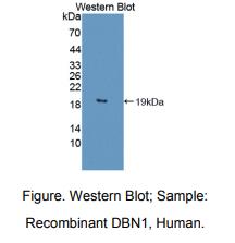 人丝织蛋白1(DBN1)多克隆抗体