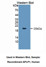 人淀粉样蛋白β前体样蛋白1(APLP1)多克隆抗体