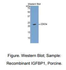 https://msimg.bioon.com/bionline/goods-no-pic.png