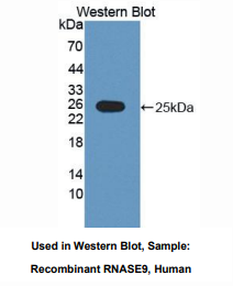 人核糖核酸酶A9(RNASE9)多克隆抗体