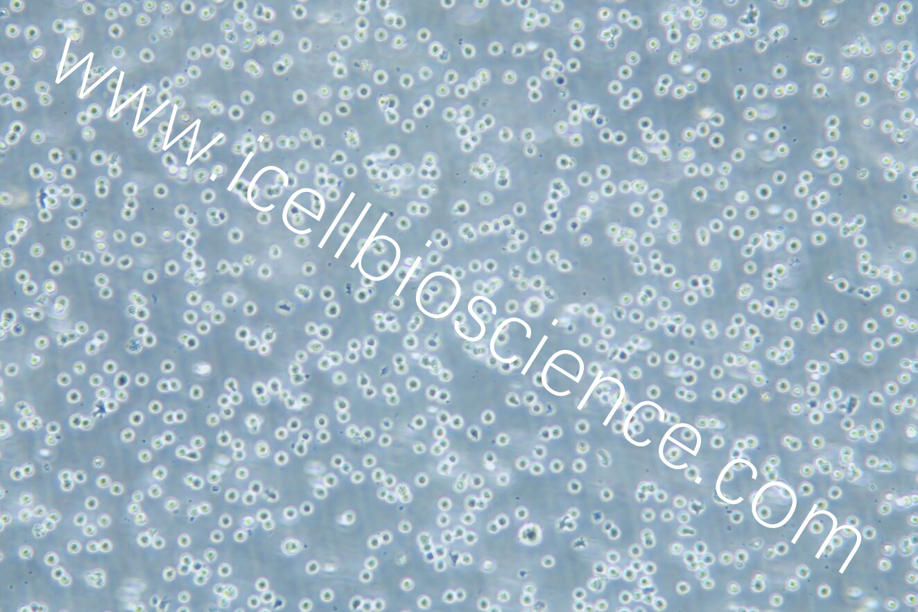 COLO 205细胞/COLO-205细胞/COLO205细胞/COLO-205/COLO205/COLO 205/人结直肠腺癌细胞