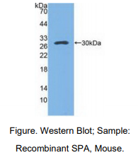 小鼠表面活性物质关联蛋白A(SFTPA1)多克隆抗体