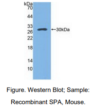 https://msimg.bioon.com/bionline/goods-no-pic.png