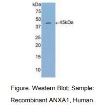 人膜联蛋白A1(ANXA1)多克隆抗体