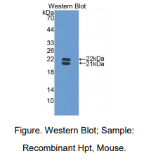 https://msimg.bioon.com/bionline/goods-no-pic.png