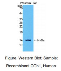 人绒毛膜促性腺激素β肽1(CGb1)多克隆抗体