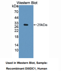 https://msimg.bioon.com/bionline/goods-no-pic.png