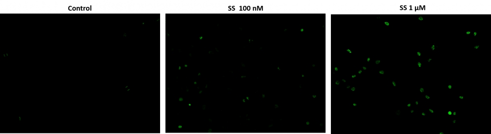 https://img.medsci.cn/e73eefcea40976357f460123cbf1e819c54e5106c9b457225be13b1cbc991aff.png