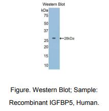 https://msimg.bioon.com/bionline/goods-no-pic.png