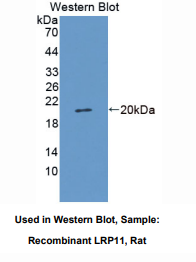 https://msimg.bioon.com/bionline/goods-no-pic.png