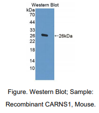 小鼠肌肽合酶1(CARNS1)多克隆抗体