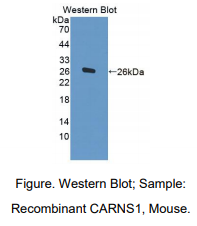 https://msimg.bioon.com/bionline/goods-no-pic.png