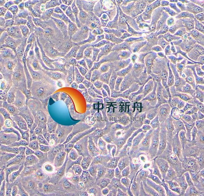 人鳞状细胞癌/扁平上皮癌细胞