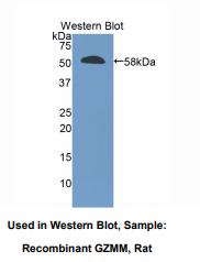 大鼠颗粒酶M(GZMM)多克隆抗体