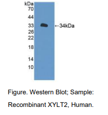 人木糖基转移酶Ⅱ(XYLT2)多克隆抗体