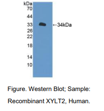 https://msimg.bioon.com/bionline/goods-no-pic.png