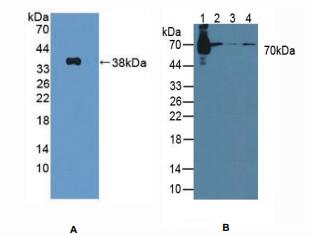 大鼠信号转导衔接分子1(STAM1)多克隆抗体