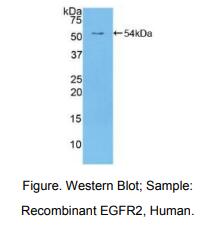 人表皮生长因子受体2(ErbB2)多克隆抗体