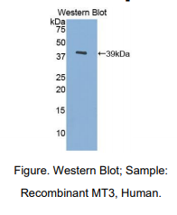 人金属硫蛋白3(MT3)多克隆抗体