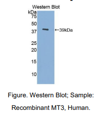 https://msimg.bioon.com/bionline/goods-no-pic.png