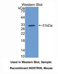 https://msimg.bioon.com/bionline/goods-no-pic.png