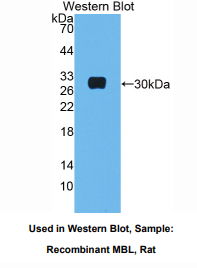 https://msimg.bioon.com/bionline/goods-no-pic.png