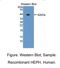 人膜铁转运辅助蛋白(HEPH)多克隆抗体