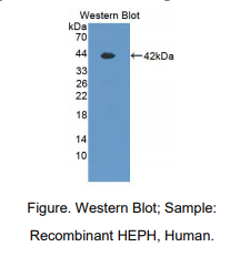 https://msimg.bioon.com/bionline/goods-no-pic.png