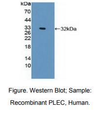 https://msimg.bioon.com/bionline/goods-no-pic.png