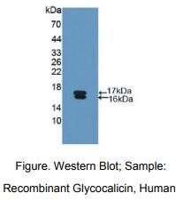 人糖盏蛋白(GC)多克隆抗体