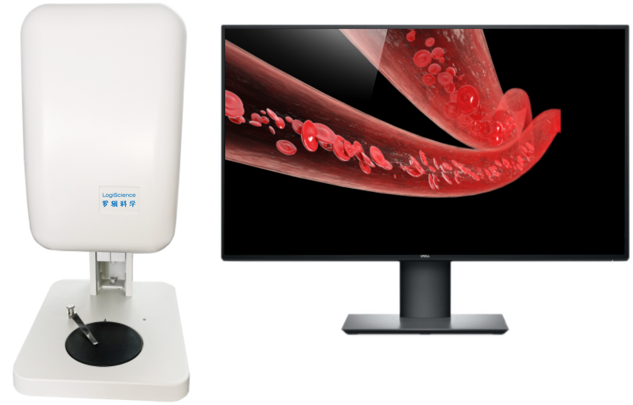 高分辨激光血流成像系统