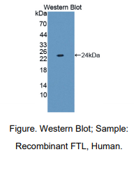 人轻肽铁蛋白(FTL)多克隆抗体