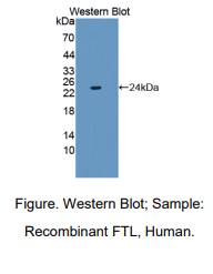 https://msimg.bioon.com/bionline/goods-no-pic.png