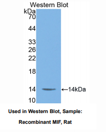 https://msimg.bioon.com/bionline/goods-no-pic.png