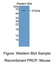 https://msimg.bioon.com/bionline/goods-no-pic.png