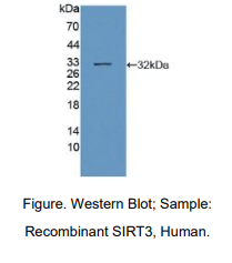 人沉默调节蛋白3(SIRT3)多克隆抗体