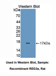 https://msimg.bioon.com/bionline/goods-no-pic.png