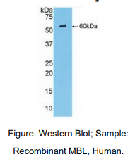 人甘露糖结合蛋白(MBL)多克隆抗体