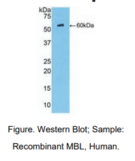 https://msimg.bioon.com/bionline/goods-no-pic.png