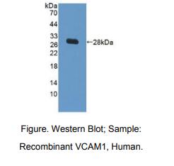 https://msimg.bioon.com/bionline/goods-no-pic.png