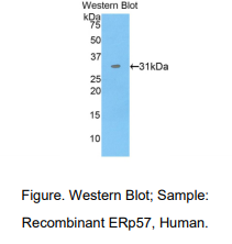 https://msimg.bioon.com/bionline/goods-no-pic.png