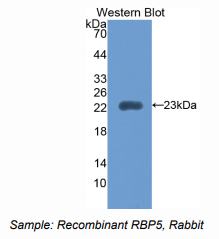 兔视黄醇结合蛋白5(RBP5)多克隆抗体