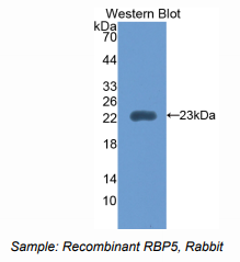 https://msimg.bioon.com/bionline/goods-no-pic.png