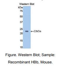 https://msimg.bioon.com/bionline/goods-no-pic.png