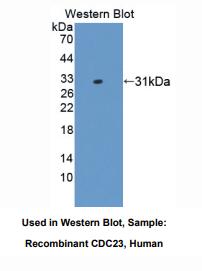 人细胞分裂周期因子23(CDC23)多克隆抗体