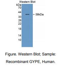 https://msimg.bioon.com/bionline/goods-no-pic.png