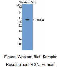 https://msimg.bioon.com/bionline/goods-no-pic.png