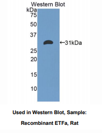 大鼠电子转移黄素蛋白α肽(ETFa)多克隆抗体
