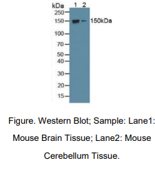 https://msimg.bioon.com/bionline/goods-no-pic.png