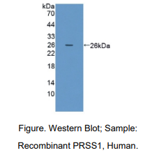 https://msimg.bioon.com/bionline/goods-no-pic.png